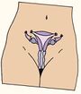 Módulo 5 Salud Sexual y Reproductiva p(31.2).jpg